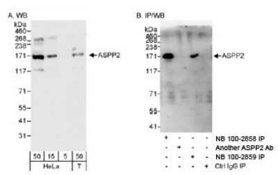 Western Blot: 53BP2 Antibody [NB100-2858]