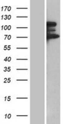 Western Blot: 53BP2 Overexpression Lysate [NBP2-10623]