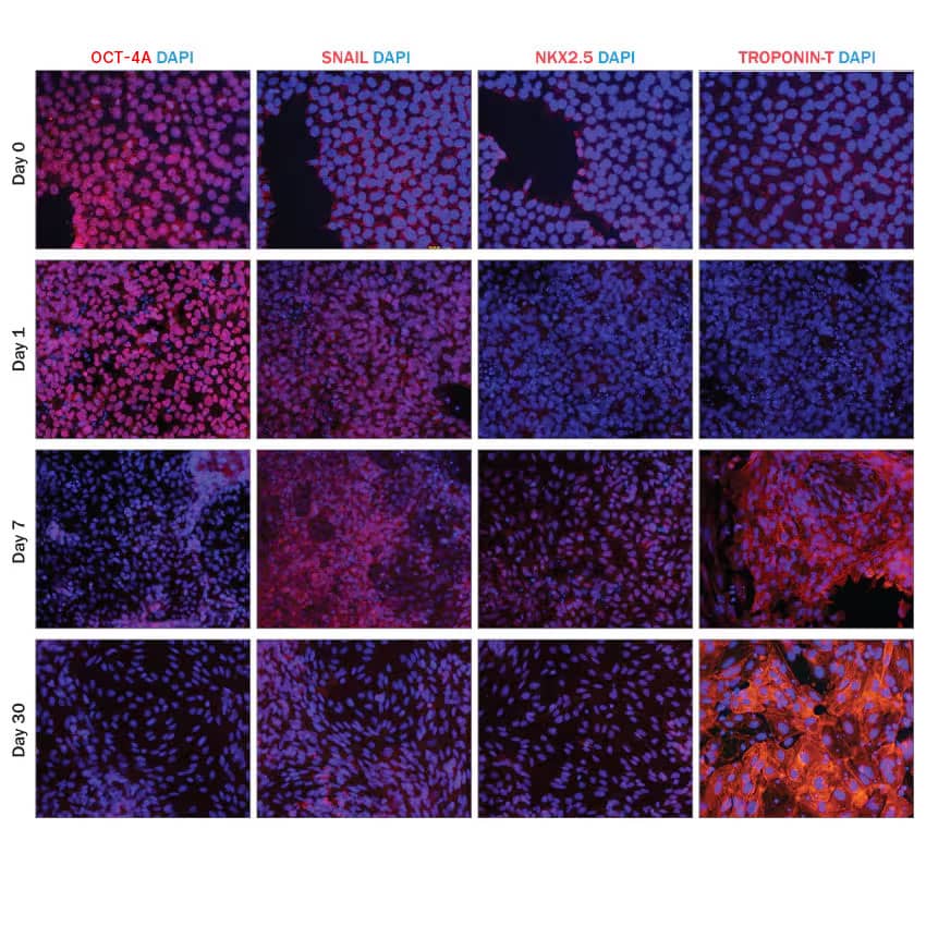 Staining for the stage-specific markers, Oct-4A, Snail, NKX2.5, and Troponin T at select time points during cardiomyocyte differentiation of iPSCs