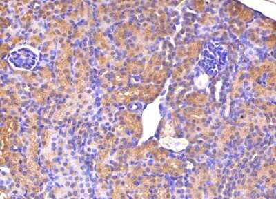 Immunohistochemistry: 58K Golgi Protein Antibody (58K-9) [NB600-412]