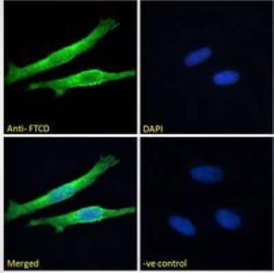 Immunocytochemistry/ Immunofluorescence: 58K Golgi Protein Antibody [NB100-1448]