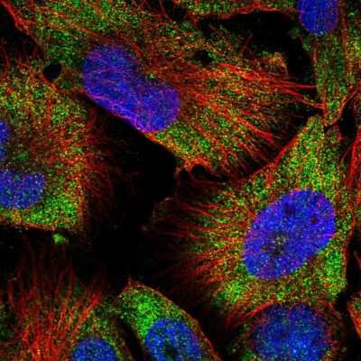 Immunocytochemistry/ Immunofluorescence: 58K Golgi Protein Antibody [NBP2-48651]