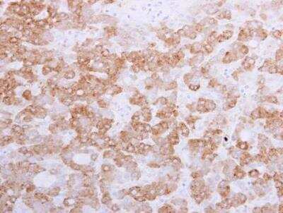 Immunohistochemistry-Paraffin: 58K Golgi Protein Antibody [NBP1-32793]