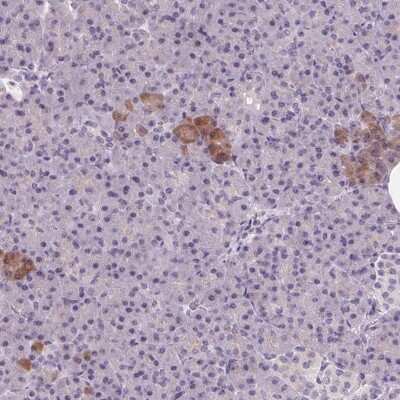 Immunohistochemistry-Paraffin: 58K Golgi Protein Antibody [NBP2-48600]