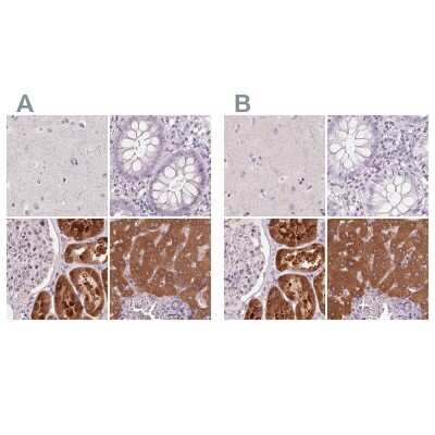 Immunohistochemistry-Paraffin: 58K Golgi Protein Antibody [NBP2-48600]