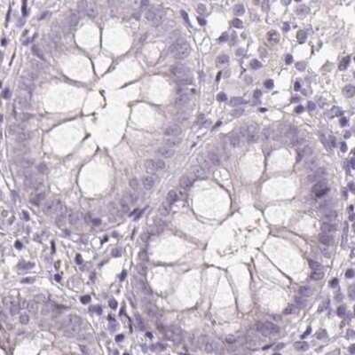 Immunohistochemistry-Paraffin: 58K Golgi Protein Antibody [NBP2-48600]