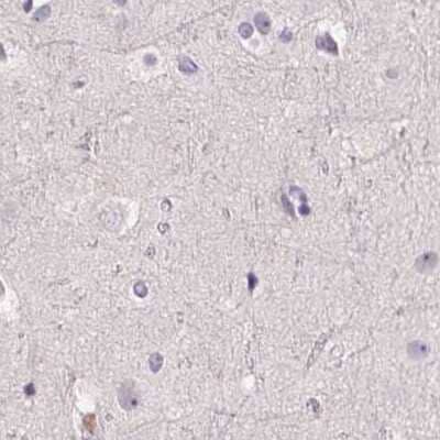 Immunohistochemistry-Paraffin: 58K Golgi Protein Antibody [NBP2-48600]