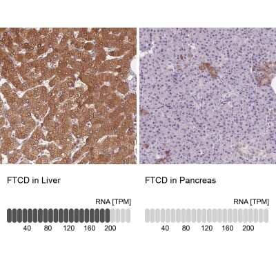 Immunohistochemistry-Paraffin: 58K Golgi Protein Antibody [NBP2-48601]