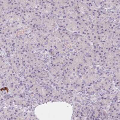 Immunohistochemistry-Paraffin: 58K Golgi Protein Antibody [NBP2-48651]