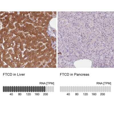 Immunohistochemistry-Paraffin: 58K Golgi Protein Antibody [NBP2-48651]