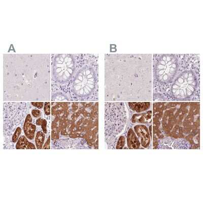 Immunohistochemistry-Paraffin: 58K Golgi Protein Antibody [NBP2-48651]