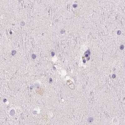 Immunohistochemistry-Paraffin: 58K Golgi Protein Antibody [NBP2-48651]