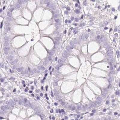 Immunohistochemistry-Paraffin: 58K Golgi Protein Antibody [NBP2-48651]