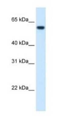 Western Blot: 58K Golgi Protein Antibody [NBP1-54997]