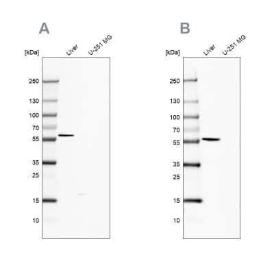 Western Blot: 58K Golgi Protein Antibody [NBP2-48600]