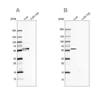 Western Blot: 58K Golgi Protein Antibody [NBP2-48651]