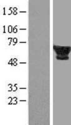 Western Blot: 58K Golgi Protein Overexpression Lysate [NBP2-10129]