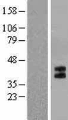 Western Blot: 5-HT1B Overexpression Lysate [NBL1-11775]