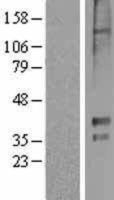 Western Blot: 5-HT1E Overexpression Lysate [NBL1-11777]