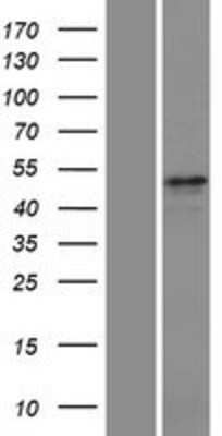 Western Blot: 5-HT2C Overexpression Lysate [NBP2-10717]