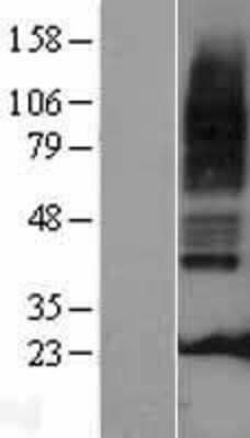 Western Blot: 5-HT3A Overexpression Lysate [NBL1-11779]