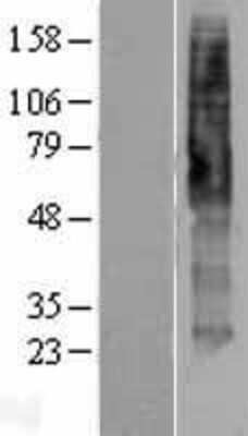 Western Blot: 5-HT4 Overexpression Lysate [NBP2-04179]