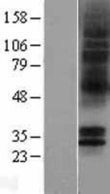 Western Blot: 5-HT5A Overexpression Lysate [NBP2-04394]