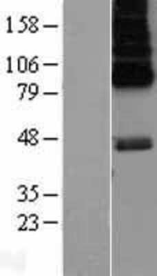 Western Blot: 5-HT6 Overexpression Lysate [NBL1-11782]