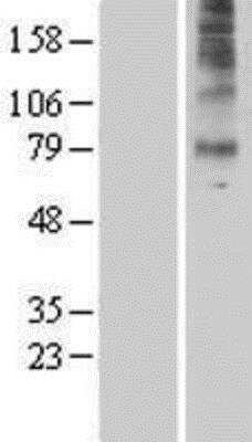 Western Blot: 5-HT7 Overexpression Lysate [NBP2-06701]