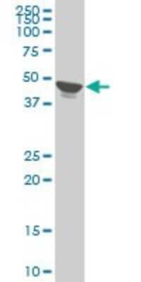 Western Blot: 5T4 Antibody (1B6) [H00007162-M09]