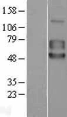 Western Blot: 5T4 Overexpression Lysate [NBL1-17210]