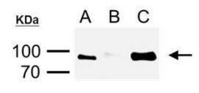 Western Blot: His Tag Antibody (359) [NBP2-43536]
