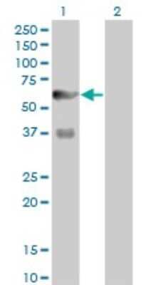 Western Blot: 6 Phosphofructo 2 Kinase Antibody (3F3) [H00005209-M08]