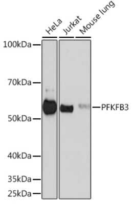 Western Blot: 6 Phosphofructo 2 Kinase Antibody (7X10D9) [NBP3-16295]