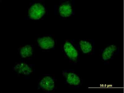Immunocytochemistry/ Immunofluorescence: 6 Phosphofructo 2 Kinase Antibody [H00005209-B01P]