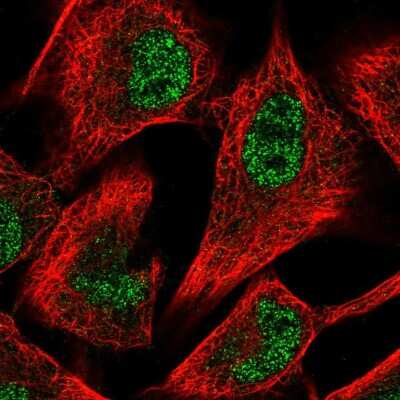 Immunocytochemistry/ Immunofluorescence: 6 Phosphofructo 2 Kinase Antibody [NBP2-55403]