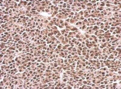 Immunohistochemistry-Paraffin: 6 Phosphofructo 2 Kinase Antibody [NBP1-31147]