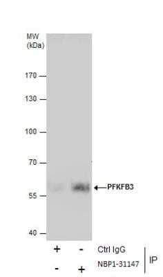 Immunoprecipitation: 6 Phosphofructo 2 Kinase Antibody [NBP1-31147]