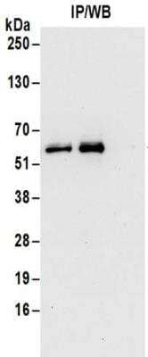 Immunoprecipitation: 6 Phosphofructo 2 Kinase Antibody [NBP2-32162]