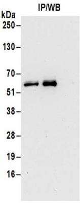 Immunoprecipitation: 6 Phosphofructo 2 Kinase Antibody [NBP2-32163]