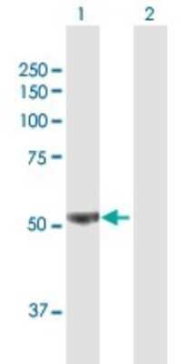 Western Blot: 6 Phosphofructo 2 Kinase Antibody [H00005209-B01P]