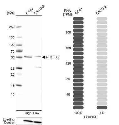 Western Blot: 6 Phosphofructo 2 Kinase Antibody [NBP1-87478]