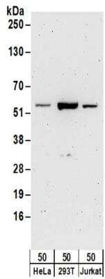 Western Blot: 6 Phosphofructo 2 Kinase Antibody [NBP2-32163]