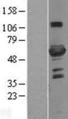 Western Blot: 6 Phosphofructo 2 Kinase Overexpression Lysate [NBL1-14312]