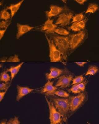 Immunocytochemistry/ Immunofluorescence: 60S ribosomal protein L23 Antibody - BSA Free [NBP2-92441]
