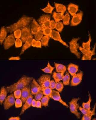 Immunocytochemistry/ Immunofluorescence: 60S ribosomal protein L23 Antibody - BSA Free [NBP2-92441]