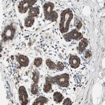 Immunohistochemistry-Paraffin: 60S ribosomal protein L23 Antibody [NBP1-87847]