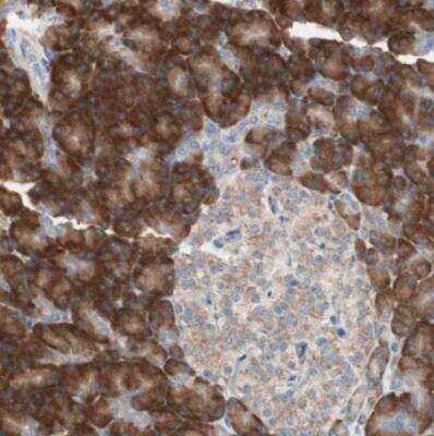 Immunohistochemistry-Paraffin: 60S ribosomal protein L23 Antibody [NBP1-87847]