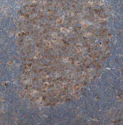 Immunohistochemistry-Paraffin: 60S ribosomal protein L23 Antibody [NBP1-87847]