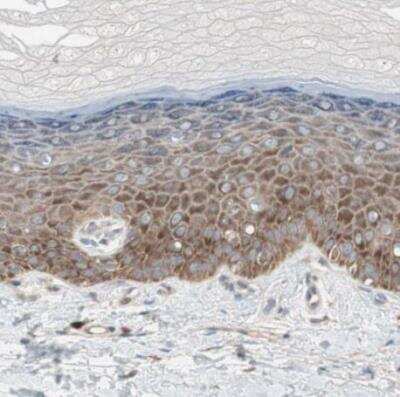 Immunohistochemistry-Paraffin: 60S ribosomal protein L23 Antibody [NBP1-87847]